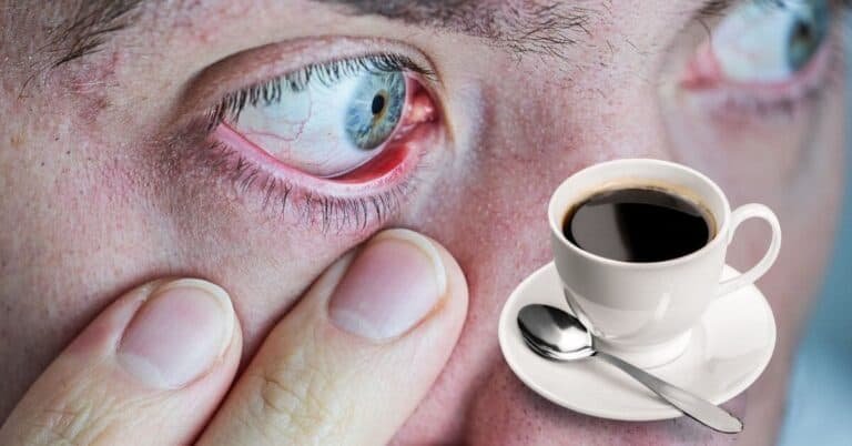 هل تسبب القهوة جفاف العين؟ كشف الحقيقة