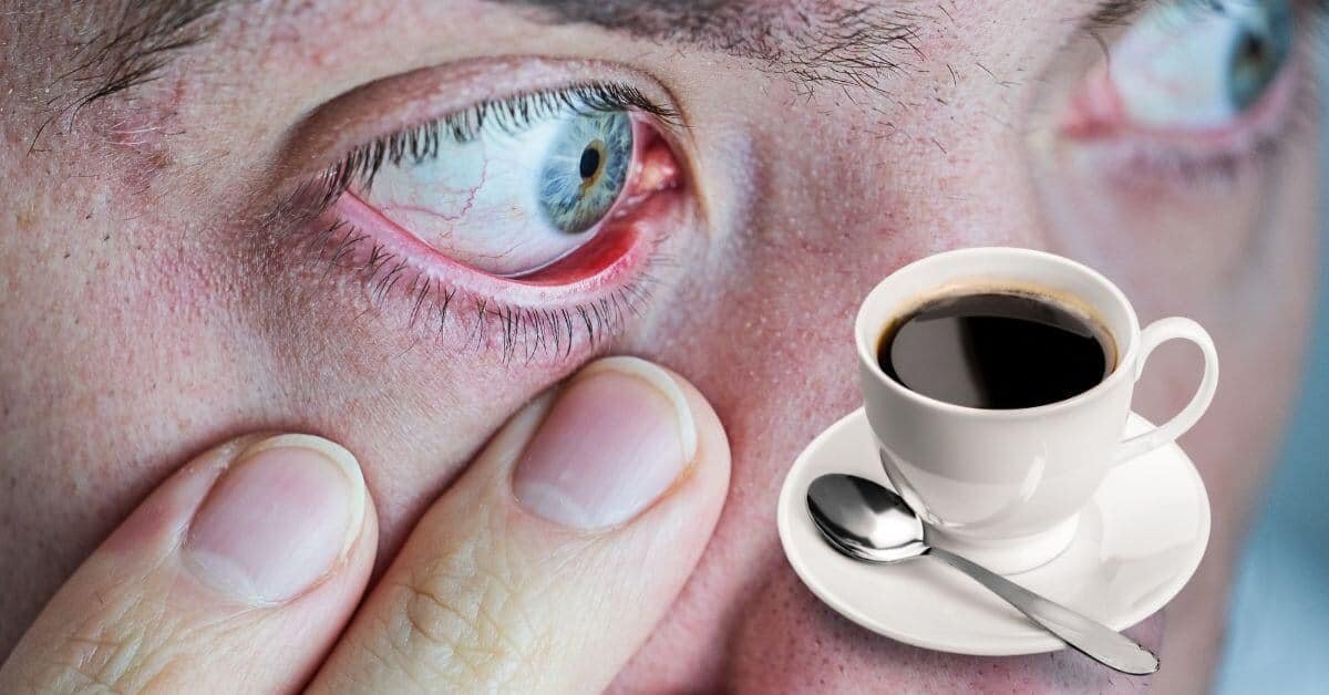 القهوة جفاف العين